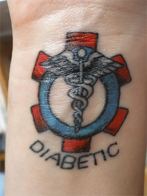 Татуировка при диабете: можно или нет?