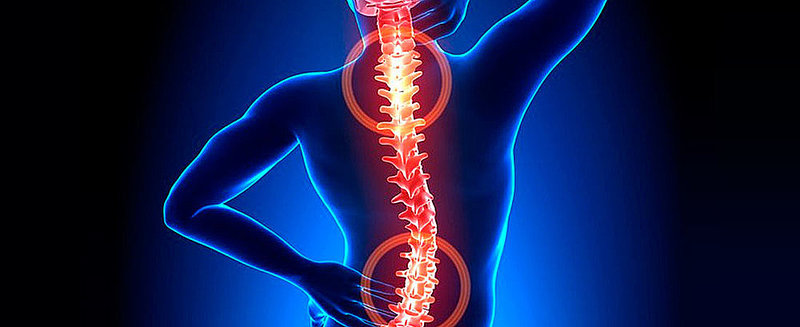 Что вызывает боль в спине?