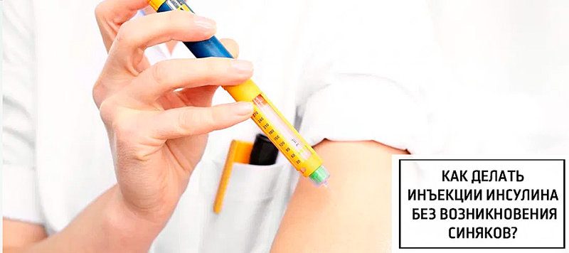 Как делать инъекции инсулина без возникновения синяков?